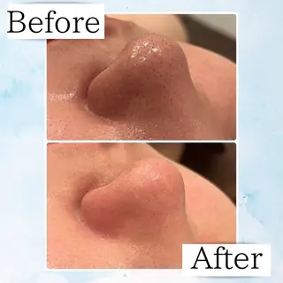 Beauty SalonEclatのエステ・リラクイメージ