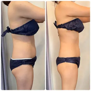 FLEUR大阪・整体 ・ハイフ・痩身・小顔のエステ・リラクイメージ