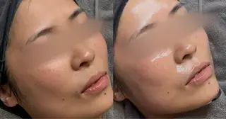 Le cherienのエステ・リラクイメージ