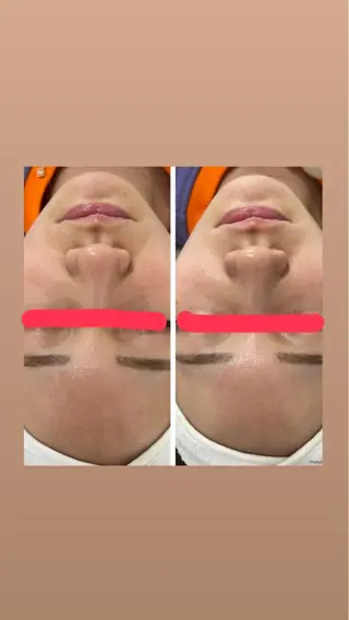 脱毛&Beauty salon IILA所属・垢抜けお手伝い💖 Sakuraの眉毛・アイブロウイメージ