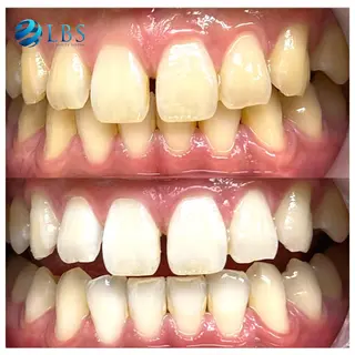 LBSホワイトニング 銀座店💎スタッフ峯のその他イメージ