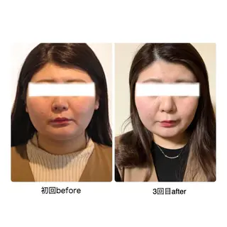 ロング カラー ヘアアレンジ ネイル 小顔矯正専門サロンジュマリ所属・町田 淳子のエステ・リラクイメージ