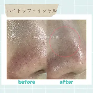 メンズ お手軽ホワイトニングsalon mina所属・武元 奈津美のエステ・リラクイメージ