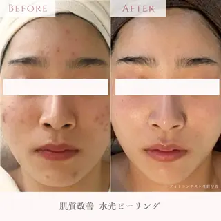 肌質改善サロン LesFleursのエステ・リラクイメージ