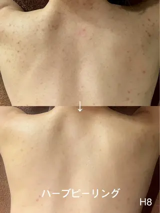 【LEPUS】 nishimoriのエステ・リラクイメージ