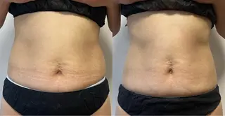 Beauty   Salon  Adiy所属・Adiy ikumiのエステ・リラクイメージ