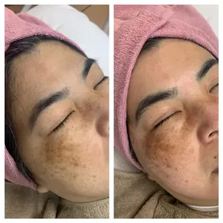 lafleur Yurinaのエステ・リラクイメージ