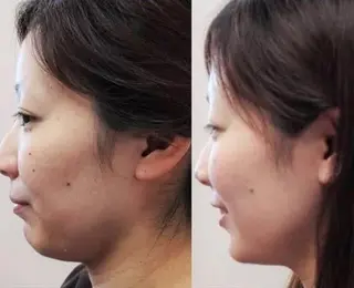 ミディアム カラー ネイル マツエク・マツパ 小顔矯正・美容鍼 美鍼堂のエステ・リラクイメージ