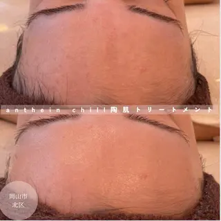 アンテインチル 山本のエステ・リラクイメージ