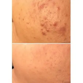 ニキビ・肌質改善専門 ♡人生が変わるサロンのエステ・リラクイメージ