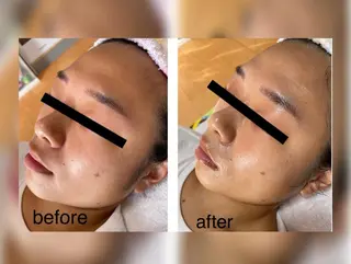 B.glossy所属・ビューティーサロン B.glossyのネイルデザイン