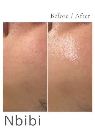 韓国🇰🇷価格 サロン_Nbibiのエステ・リラクイメージ