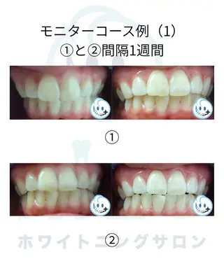 カラー ミディアム ホワイトニングサロン nico西葛西店のその他イメージ