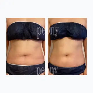 デトックス美容専門サロンpeony所属・デトックス美容専門 サロンpeonyのエステ・リラクイメージ