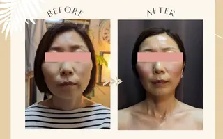 stress care salon　海と猫所属・小顔salon 古田琴のエステ・リラクイメージ