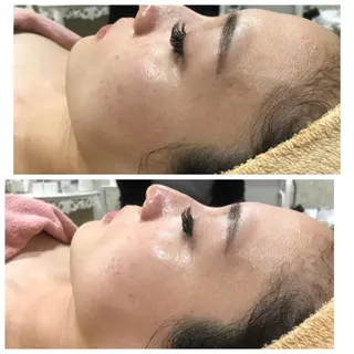 フェイシャル/脱毛 ジョアアンジェ　田中のエステ・リラクイメージ