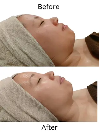 美肌脱毛＆小顔・フェ イシャル【SONA】のエステ・リラクイメージ