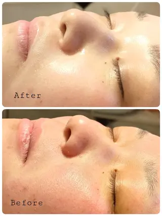 Aeri所属・Aeri salon.Yのエステ・リラクイメージ