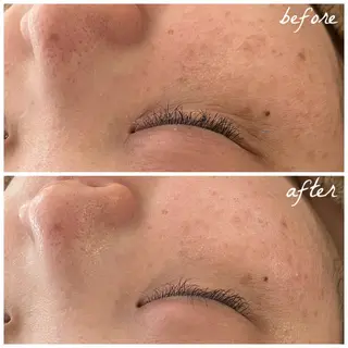 メンズ メナード岐阜茜部 杉浦のエステ・リラクイメージ