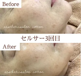 都度払い 肌質改善専門サロンのエステ・リラクイメージ