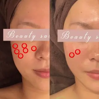 痩身×フェイシャル ブライダル|Linoのエステ・リラクイメージ