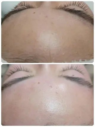 Lutella所属・ワックス脱毛専門店 Lutellaのエステ・リラクイメージ