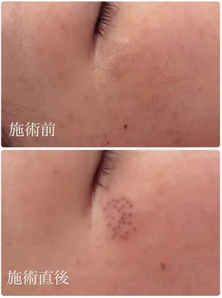 emiluka beautyのエステ・リラクイメージ