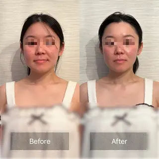 Hi, I am 1 PARAFUSE.所属・カラダとココロ 癒されほっと一息のエステ・リラクイメージ