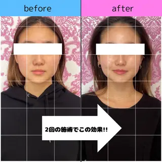 小顔矯正専門店 【RED】池田のエステ・リラクイメージ