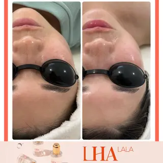 Liam《美肌管理/ 3D小顔/脂肪ケア》のその他イメージ