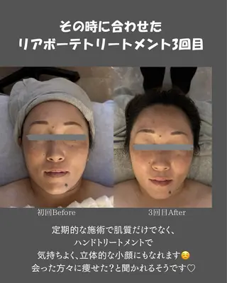 BLOSSOM 菊地のエステ・リラクイメージ