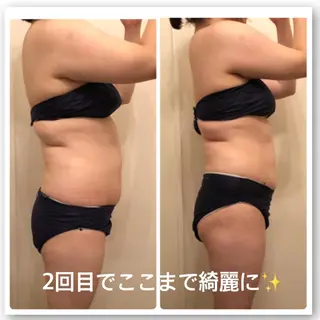 FLEUR大阪・美容 整体・痩身・小顔のエステ・リラクイメージ