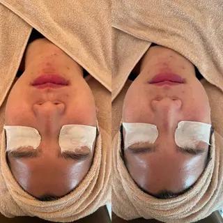 メンズ 毛穴ケア/毛穴診断/ 毛穴洗浄〔心斎橋〕のエステ・リラクイメージ