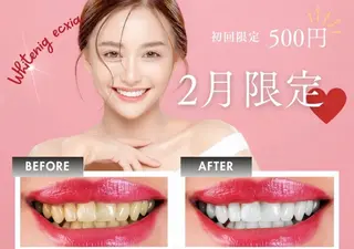 ecxia  white 　広島袋町店所属・セルフホワイトニング エクシア広島袋町店のその他イメージ