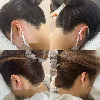 うなじ脱毛/美肌脱毛 LABELのエステ・リラクイメージ