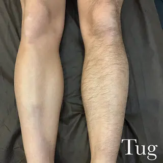 エステサロンTug高知駅前店所属・Tug 高知駅前店/ NANAMIのその他イメージ