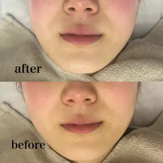 フェイシャルサロン CHIARA 荒田のエステ・リラクイメージ