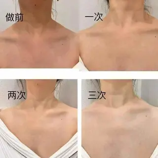 マツエク・マツパ aliaハイフ&水光ジェットサロン所属・aliaハーブ水光店 エステティシャン募集のエステ・リラクイメージ