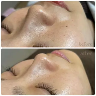 meili beautyのエステ・リラクイメージ