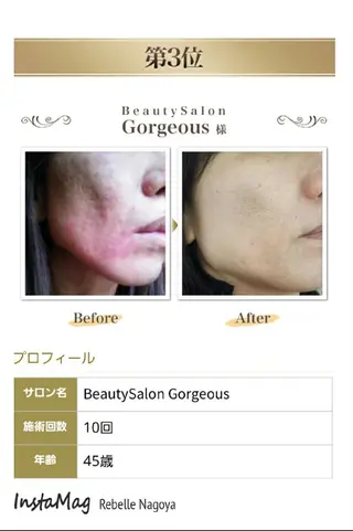 ミディアム パーマ カラー ヘアアレンジ ネイル キッズ メンズ マツエク・マツパ 次世代まつげパーマは 『リベル名古屋』のマツエク・マツパデザイン