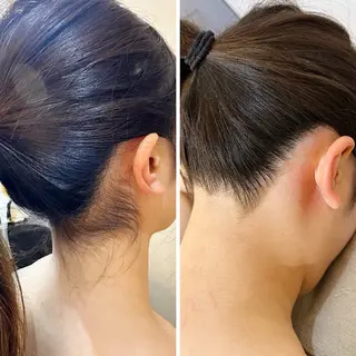 うなじ脱毛/美肌脱毛 LABELのエステ・リラクイメージ