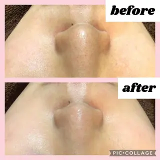 エヴァーグレース 河原町店のエステ・リラクイメージ