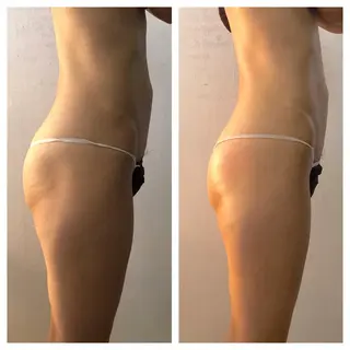 小顔・痩身専門店 Sunao所属・小顔.足痩せ整体 痩身天六Sunaoのその他イメージ