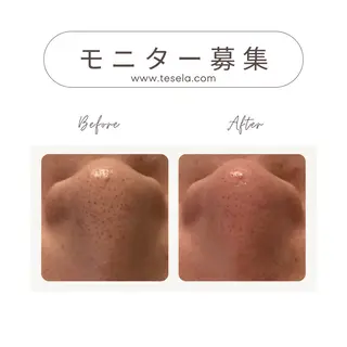 Body care TESELA所属・長谷川 麻衣湖のエステ・リラクイメージ