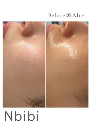 韓国🇰🇷価格 サロン_Nbibiのエステ・リラクイメージ