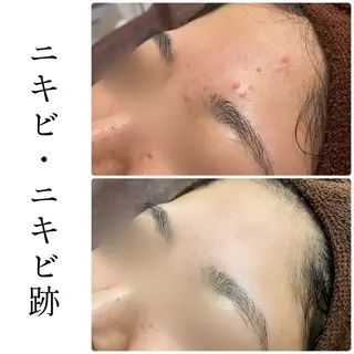 ハーブピーリング専門 BIOEL横浜のエステ・リラクイメージ