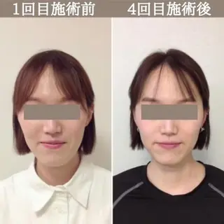 美容整体サロン Chare人形町店のエステ・リラクイメージ