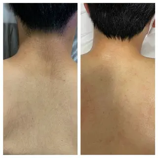 メンズ Lumus Solarum所属・Lumus Solarumのエステ・リラクイメージ