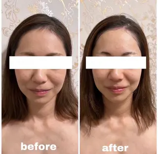 西区九条エステ MITUREIサロンのエステ・リラクイメージ