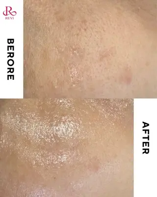 skinity所属・ピーリング専門サロン skinityのエステ・リラクイメージ